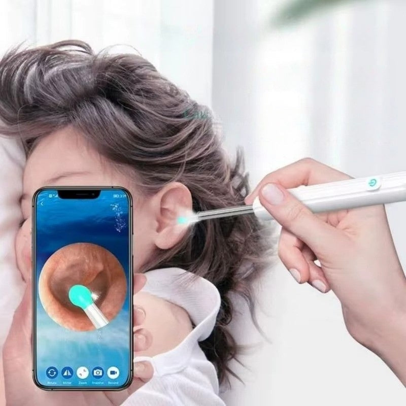 EarView – Ørevoksrens Sett med Kamera og LED-Lys