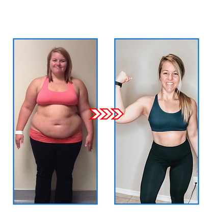 FitAura - Sirkulasjonsfremmende og hudoppstrammende sokker for slankere benp | 1+1 Gratis